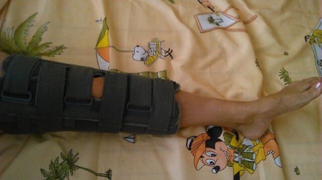 Immobilisation de l'articulation du genou en cas de douleur
